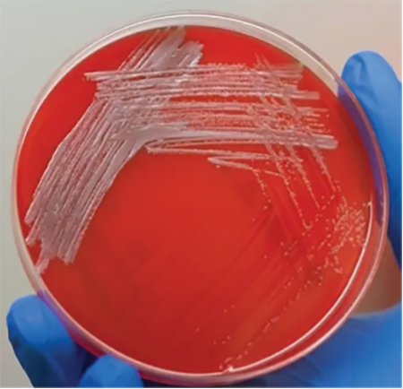 Fig 2: 5% sheep's blood agar plate growing Brucella melitensis