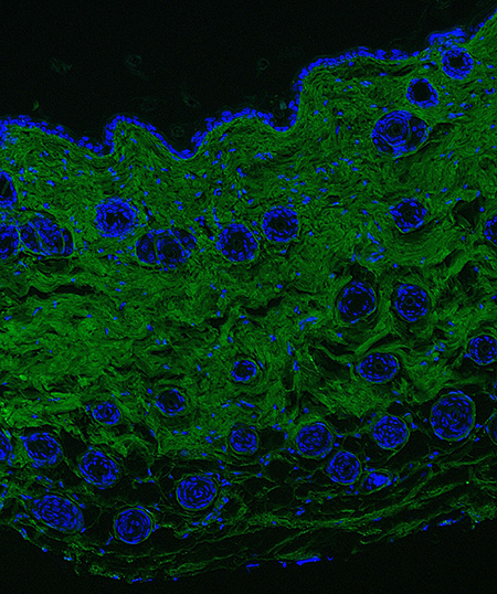 Fluorescent collagen deposition assay