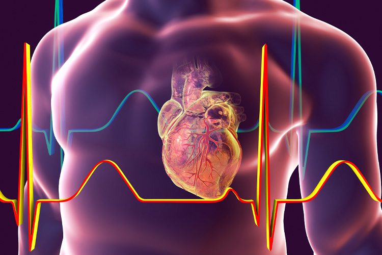 Heart with coronary vessels